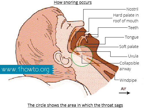 How Snoring Occurs